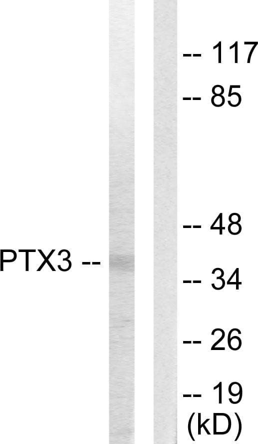 PTX3 / Pentraxin 3 Antibody