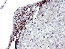PARVB Antibody (clone OTI1B9)