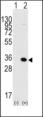 Polyclonal Rabbit anti-Human MBD3 Antibody (aa264-291, IHC, WB)