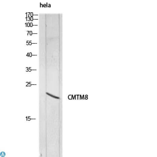 CMTM8 Antibody