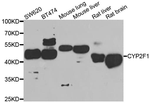 Polyclonal Rabbit anti-Human CYP2F / CYP2F1 Antibody (IHC, WB)