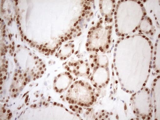 MGMT Antibody (clone OTI10H9)