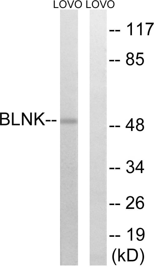 Polyclonal Rabbit anti-Human BLNK Antibody (aa62-111, IHC, WB)