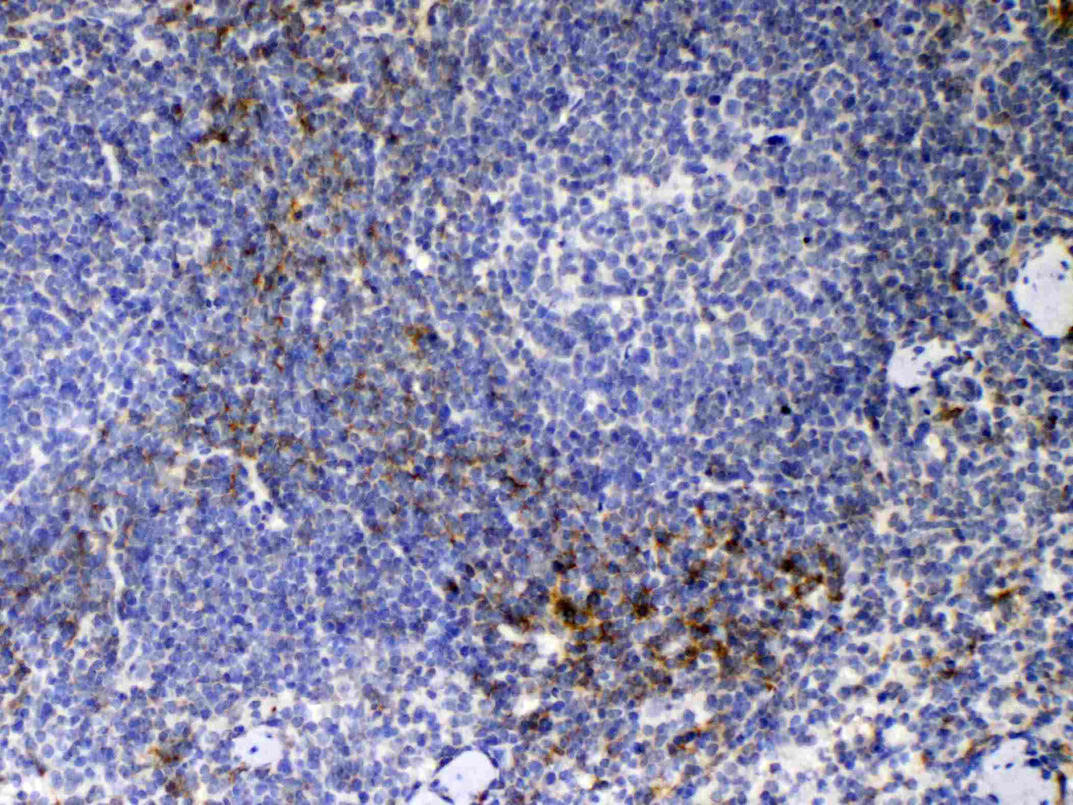 Monoclonal Mouse anti-Mouse CD14 Antibody (IHC, WB)