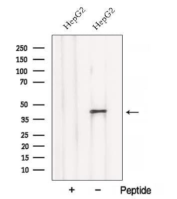 Polyclonal Rabbit anti-Human BCAT2 Antibody (WB)