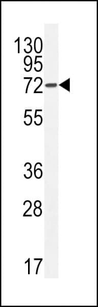 Polyclonal Rabbit anti-Human Apg7 / ATG7 Antibody (aa540-569, IHC, WB)