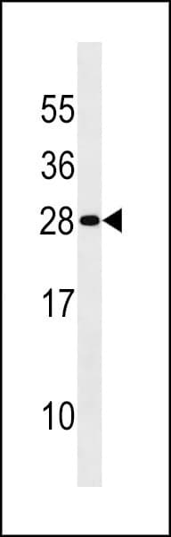 Polyclonal Rabbit anti-Human DENR / Density Regulated Antibody (aa47-76, WB)