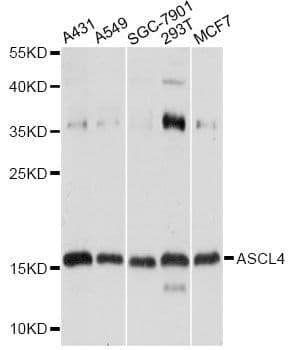 Polyclonal Rabbit anti-Human ASCL4 Antibody (WB)
