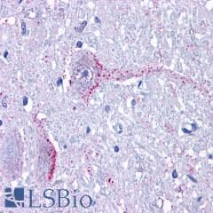 PathPlus™ Polyclonal Rabbit anti-Human GPR6 Antibody (Cytoplasmic Domain, IHC)