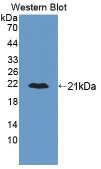 ALDH2 Antibody (aa59-150)