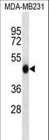 Polyclonal Rabbit anti-Human WIPI2 Antibody (aa4-32, IHC, WB)