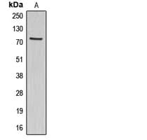 Polyclonal Rabbit anti-Human ABCG1 Antibody (C-Terminus, WB)