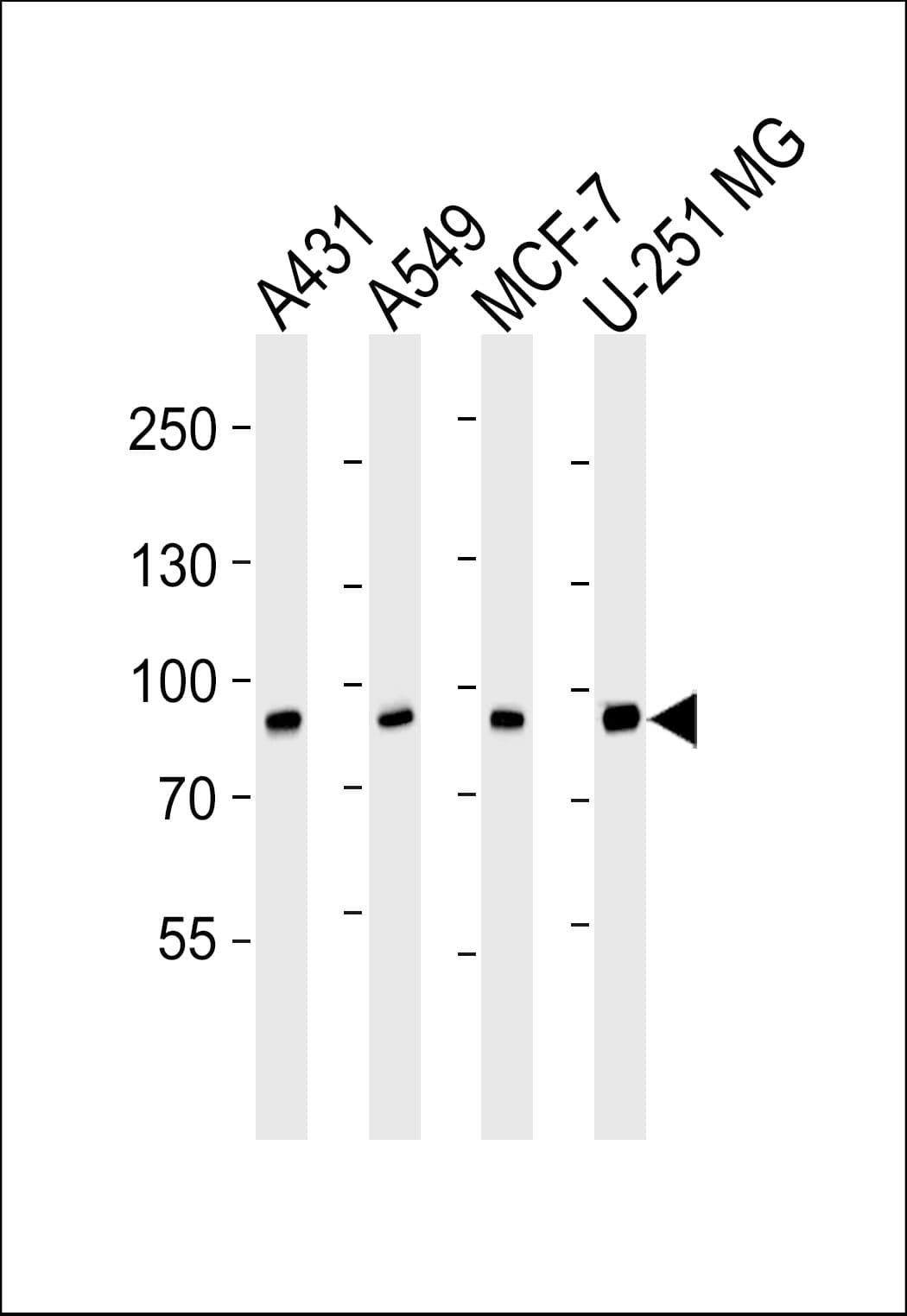 IHC-plus™ CAPN1 / Calpain 1 Antibody (aa1-420, clone 1376CT809.24.85)