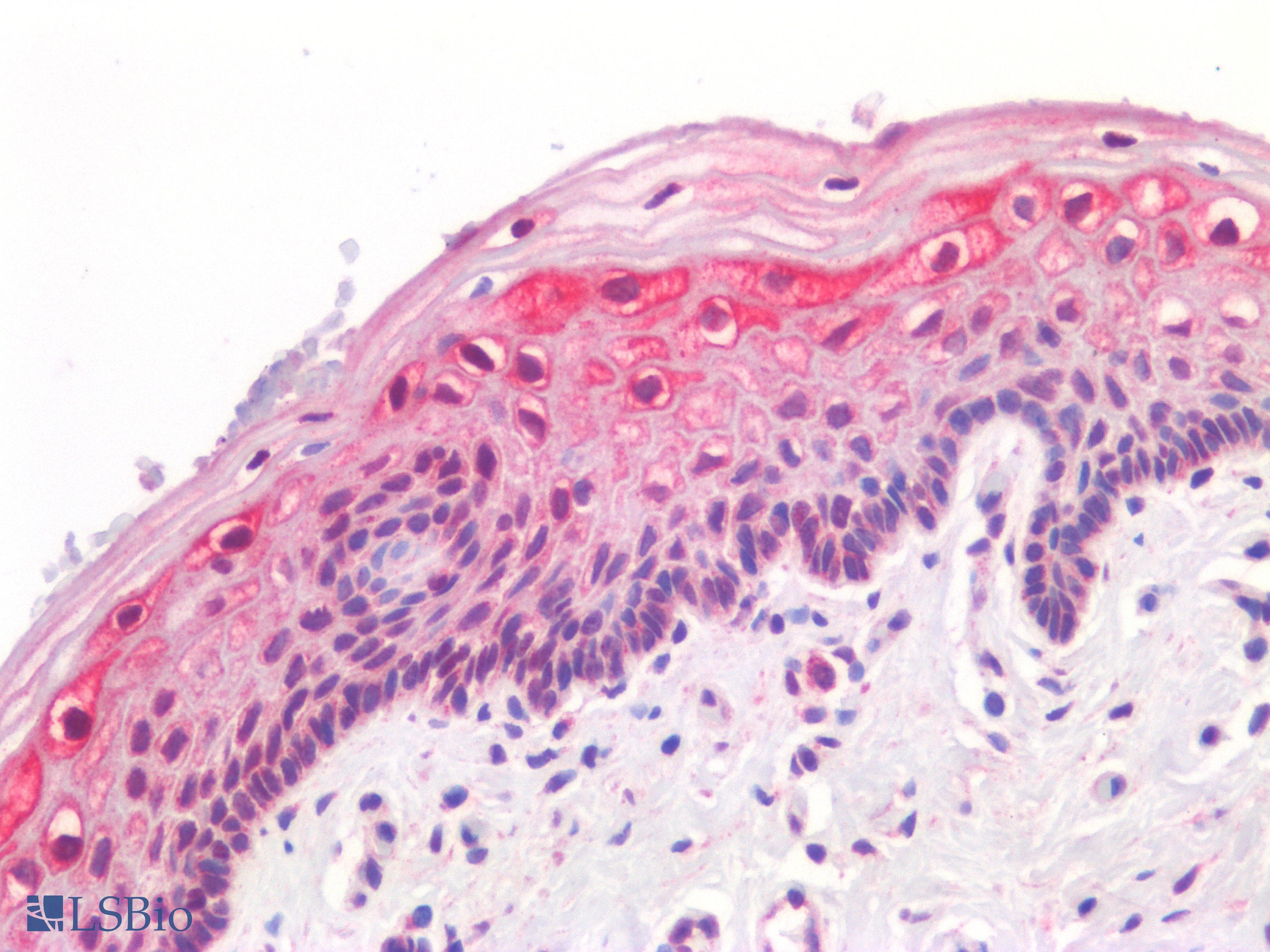 IHC-plus™ GREM1 / Gremlin-1 Antibody