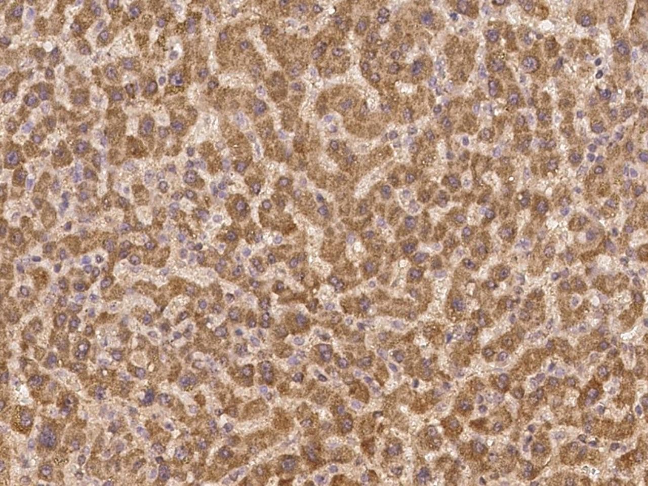 ZNF480 Antibody