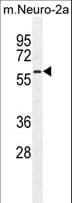 Polyclonal Rabbit anti-Human PARP6 Antibody (aa508-538, WB)