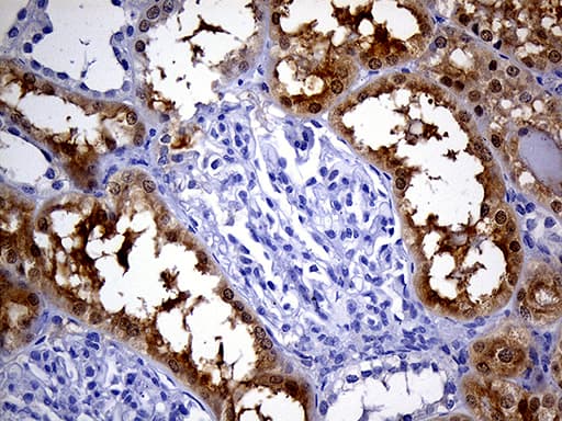 Monoclonal Mouse anti-Human PHYHD1 Antibody (clone OTI1A6, IHC, WB)