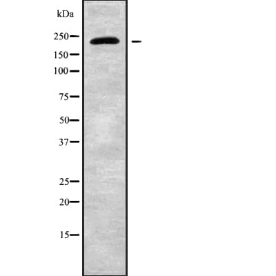 CHD2 Antibody