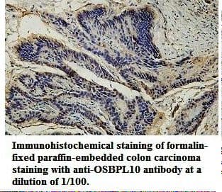 OSBPL10 Antibody (aa340-622)