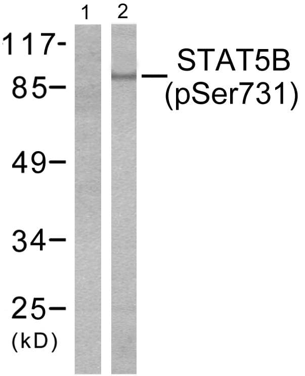 STAT5B Antibody (phospho-Ser731)