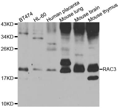 RAC3 Antibody