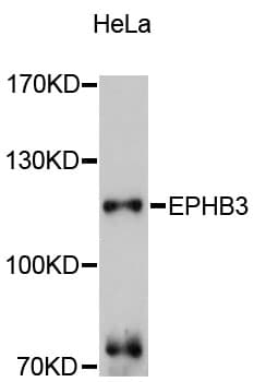 EPHB3 / EPH Receptor B3 Antibody