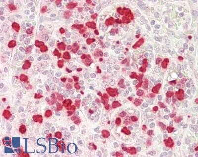 IHC-plus™ S100A8 / MRP8 Antibody (aa 1-93)