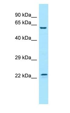 FGF17 Antibody (aa85-134)