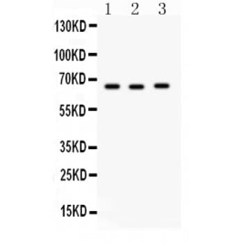 Polyclonal Rabbit anti-Human SLC19A1 Antibody (aa202-231, WB)