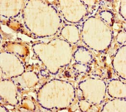 Polyclonal Rabbit anti-Human ICE1 Antibody (IHC, WB)