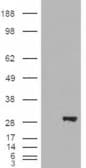 IHC-plus™ Polyclonal Goat anti-Human BDH2 Antibody (aa60-71, IHC, WB)