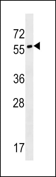 Polyclonal Rabbit anti-Human SYT17 Antibody (aa121-150, WB)