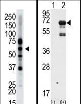 EPN2 Antibody (aa6-36)