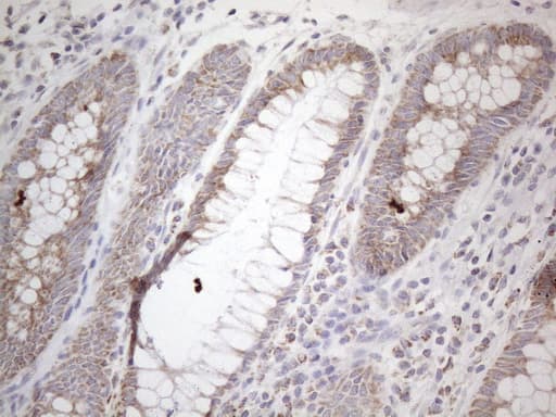 Monoclonal Mouse anti-Human BP1 / DLX4 Antibody (clone OTI8A1, IHC, WB)