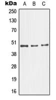 Polyclonal Rabbit anti-Human MAPK10 / JNK3 Antibody (C-Terminus, IF, WB)