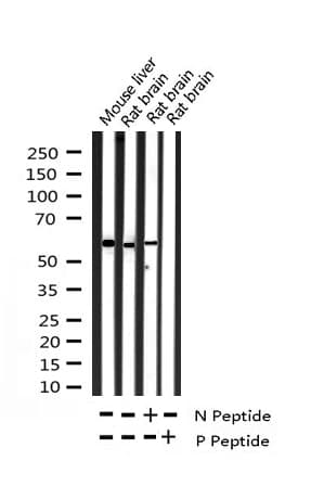 SYN / FYN Antibody (phospho-Tyr530)