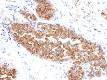 EMA / MUC1 Antibody (clone MUC1/845)