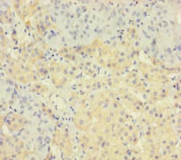 TAF12 Antibody (aa1-161)
