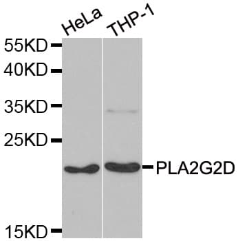 IHC-plus™ Polyclonal Rabbit anti-Human PLA2G2D Antibody (IHC, IF, WB)