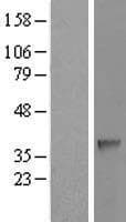 Human SDSL / Serine Dehydratase-Like Protein (Over-Expression Lysate Myc-DDK (Flag))