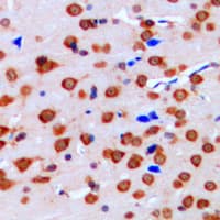 ERK1 + ERK2 Antibody (Internal)