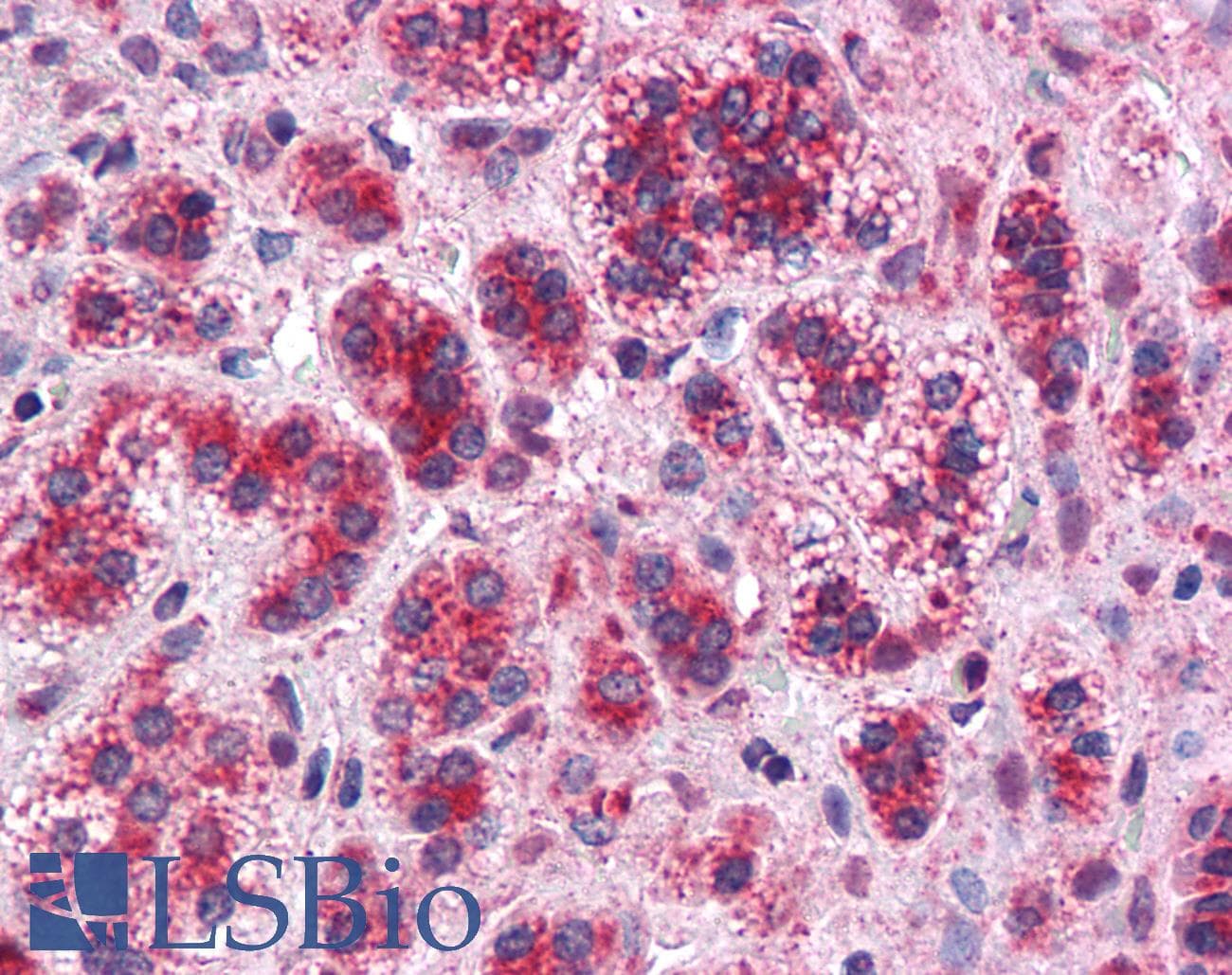 IHC-plus™ Polyclonal Rabbit anti-Human TMEM33 Antibody (Internal, IHC)