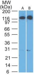 Polyclonal Rabbit anti-Human CDH4 / R Cadherin Antibody (WB)