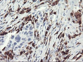 SDS Antibody (clone OTI4C3)