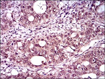 Monoclonal Mouse anti-Human TBXT / T / Brachyury Antibody (clone 1H9A2, Amino Acid: 257-309, IHC, WB)