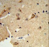 DTX4 Antibody (aa56-83)