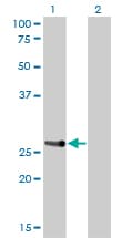 HOXA7 Antibody (clone 2F2)