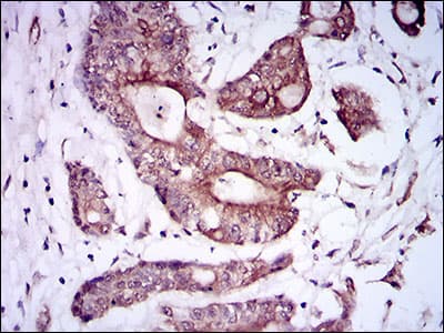 Monoclonal Mouse anti-Human ALK3 / BMPR1A Antibody (clone 4B7B2, aa179-378, IHC, WB)