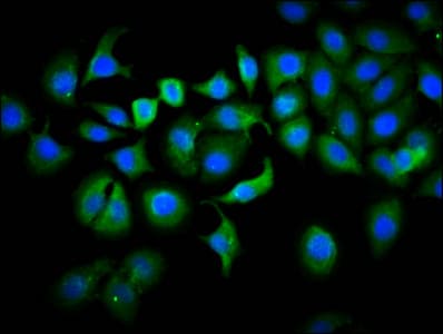 Polyclonal Rabbit anti-Human PLS1 / Fimbrin Antibody (IHC, IF, WB)