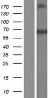 Human PRMT3 Protein (Over-Expression Lysate Myc-DDK (Flag))